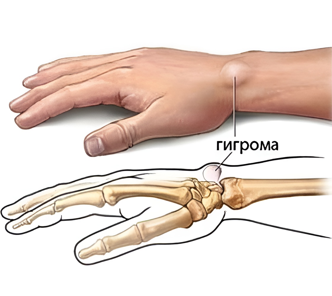 geegroma